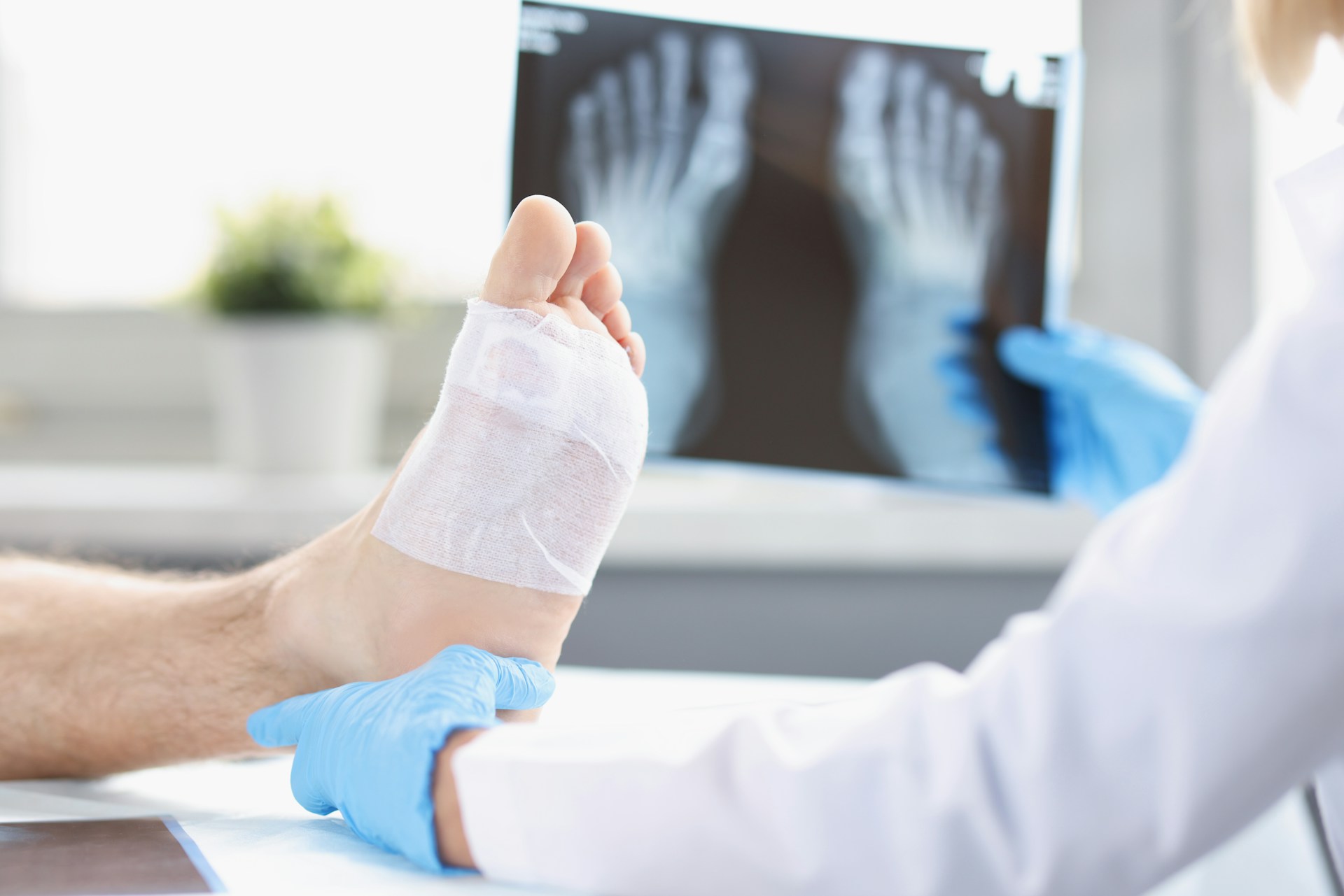 Injury examination in Mesa, Arizona, with a bandaged foot and X-ray analysis by a medical professional.